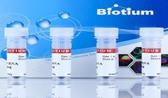 Biotium introduces unique super-sensitive RNA Prestain Loading Dye