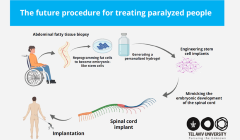 Israel’s TAU breakthrough offers new hope to help people with paralysis walk again