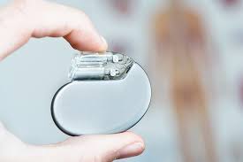 Global pacemakers market set to grow at 5.4% CAGR over next 3 years: GlobalData
