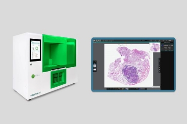 Xyall and Indica Labs forge collaboration to transform precision oncology workflows
