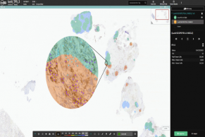 Indica Labs and Lunit enters into alliance for digital pathology AI workflows
