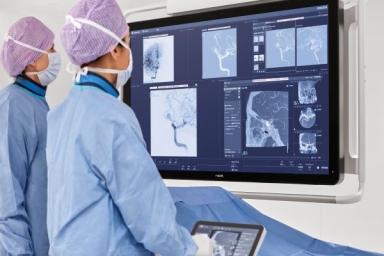 Philips' direct-to-angio stroke pathway demonstrates improved patient outcomes