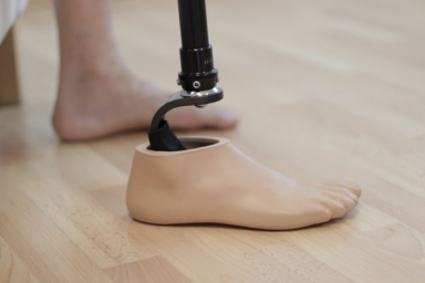 Biovyn PVC to be used in sustainable prosthetics for the first time