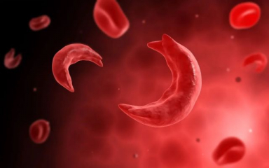 India screens 1 crore+ person for Sickle Cell Disease
