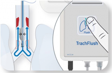 Asahi Kasei Medical and AW Technologies enter exclusive distribution agreement for TrachFlush in Japan