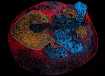 Oxford-ZEISS advances breakthrough live-cell imaging platform for next-gen drug discovery