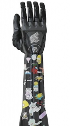 Motorica India CRE programme enhances clinician training and patient-centric prosthetic care