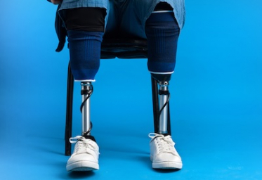 Motorica India CRE programme enhances clinician training and patient-centric prosthetic care