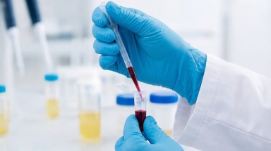 Leinco Technologies and CellCarta partner to advance proteomics in immuno-oncology