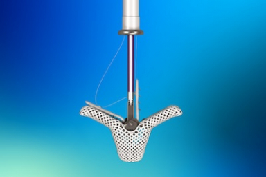 Abbott launches minimally invasive TriClip therapy in India