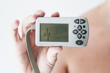 HeartBeam study shows pocket-sized ECG device can predict heart attack risk