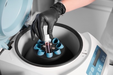 T-CURX gets Swissmedic nod for first human trial of non-viral CAR-T therapy