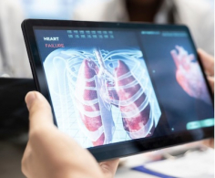 Optellum, Coreline Soft partner to advance AI-powered lung nodule management