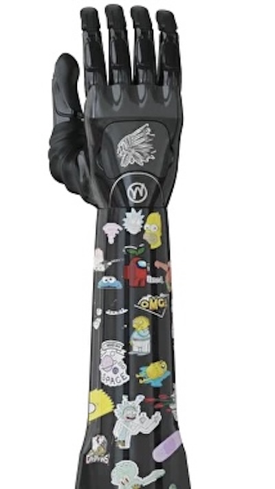 Motorica India CRE programme enhances clinician training and patient-centric prosthetic care