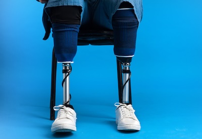 Motorica India CRE programme enhances clinician training and patient-centric prosthetic care