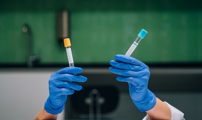 Cubo set to transform decentralised diagnostics with Compact RT-PCR innovation